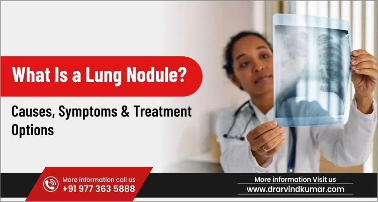 Doctor reviewing a chest X-ray showing a lung nodule finding