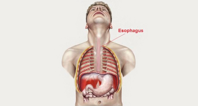 Esophageal%20(food%20pipe)%20surgery%20835X450.png