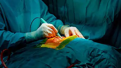 Lung cancer treatment and surgery in India