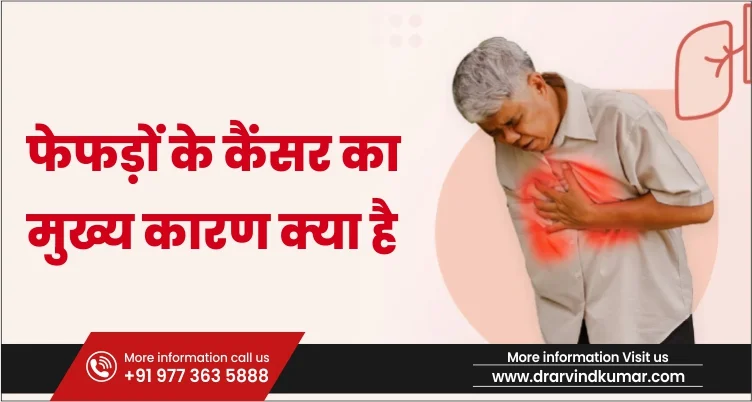 You are currently viewing फेफड़ों के कैंसर का मुख्य कारण क्या है?( What is the main cause of lung cancer?)