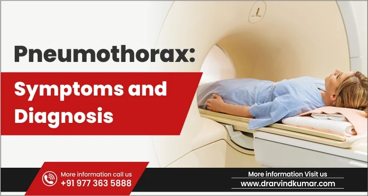 Read more about the article Pneumothorax: Symptoms and Diagnosis