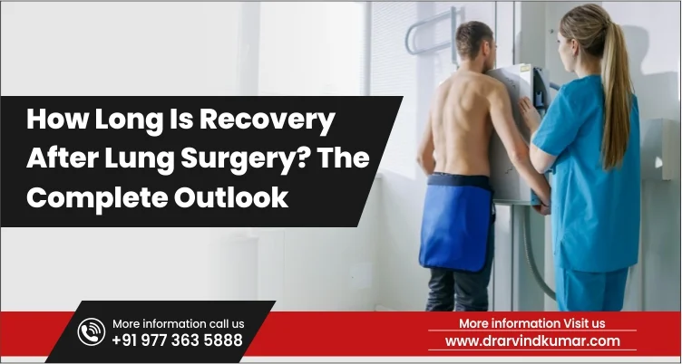 You are currently viewing How Long Is Recovery After Lung Surgery? The Complete Outlook