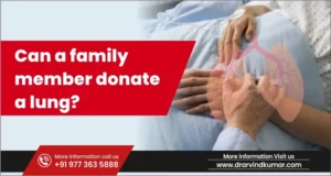 Read more about the article Can a family member donate a lung?