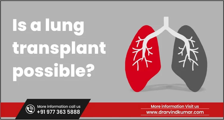 Read more about the article Is a lung transplant possible?