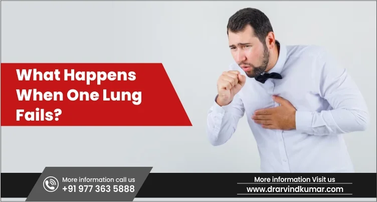 You are currently viewing What Happens When One Lung Fails?