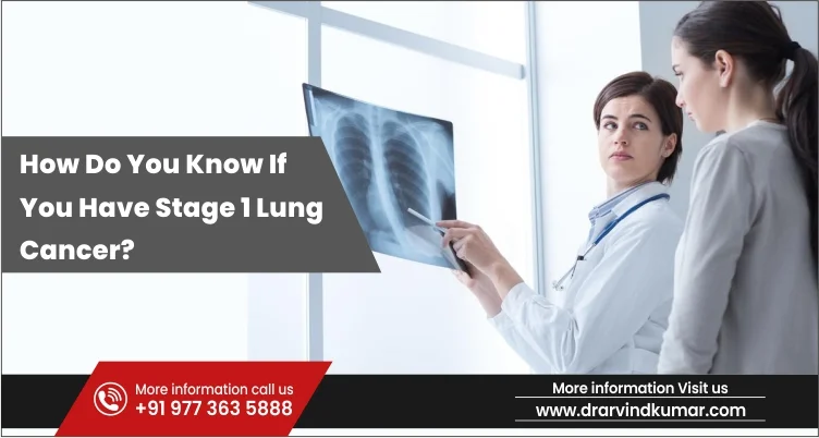 Read more about the article How Do You Know If You Have Stage 1 Lung Cancer?