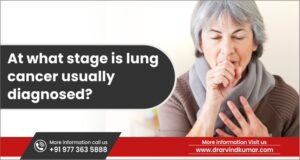 Read more about the article At What Stage Is Lung Cancer Usually Diagnosed? Understand The Staging And Screening