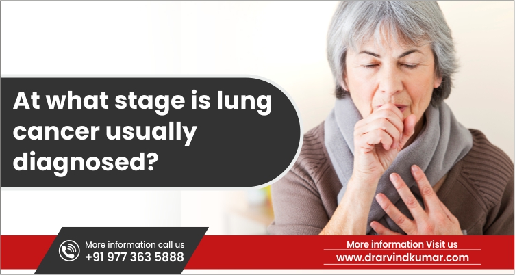 You are currently viewing At What Stage Is Lung Cancer Usually Diagnosed? Understand The Staging And Screening