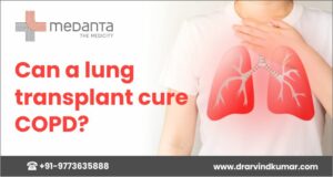 Read more about the article Can a lung transplant cure COPD?