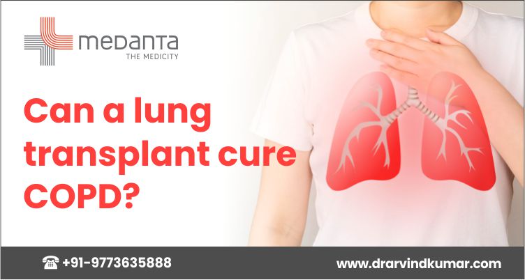 You are currently viewing Can a lung transplant cure COPD?