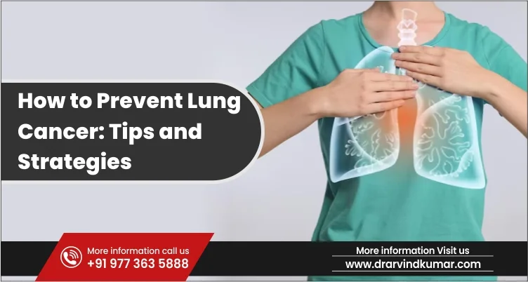 Read more about the article How to Prevent Lung Cancer: Tips and Strategies
