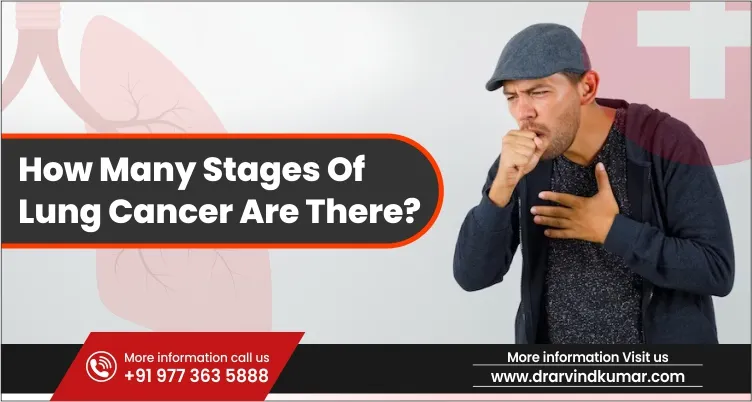 You are currently viewing How Many Stages of Lung Cancer Are There?
