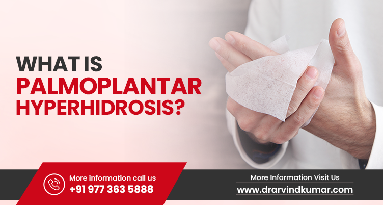 What Is Palmoplantar Hyperhidrosis- See this informative guide to know the causes and possible treatments