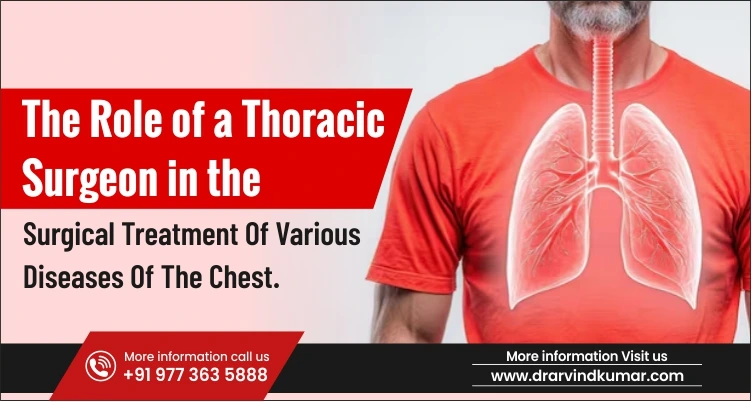 Lung cancer