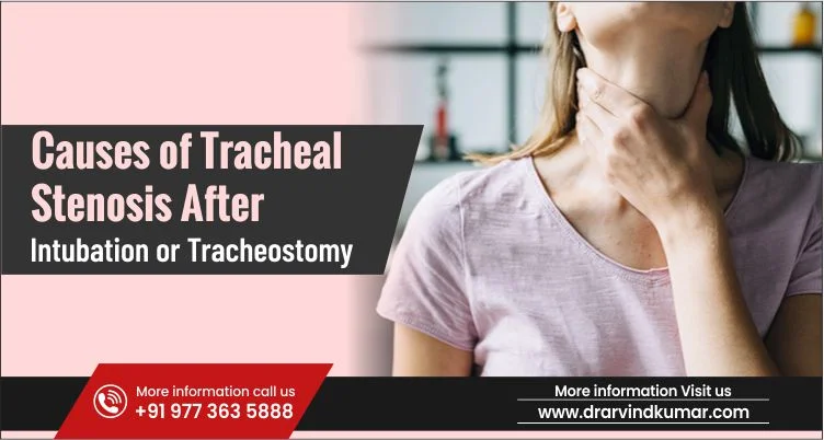 Causes of Tracheal Stenosis After Intubation or Tracheostomy