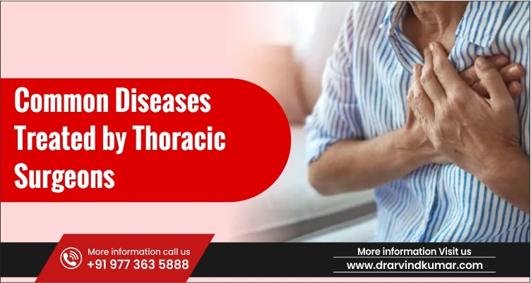 Common Diseases Treated by Thoracic Surgeons