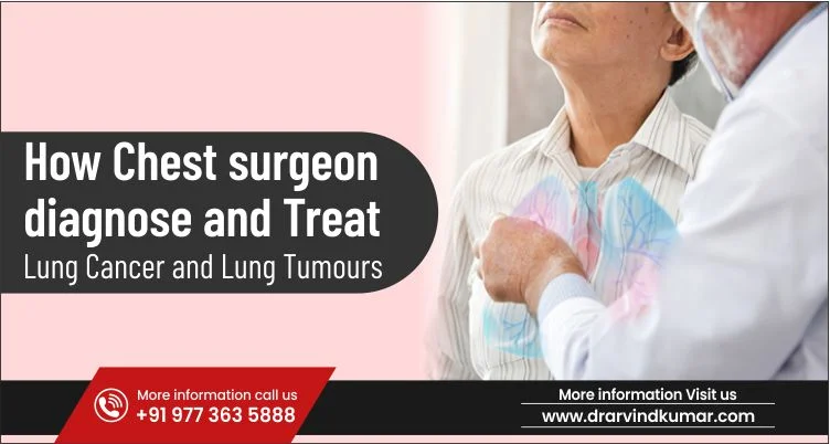 How Chest Surgeons Diagnose and Treat Lung Cancer and Lung Tumors
