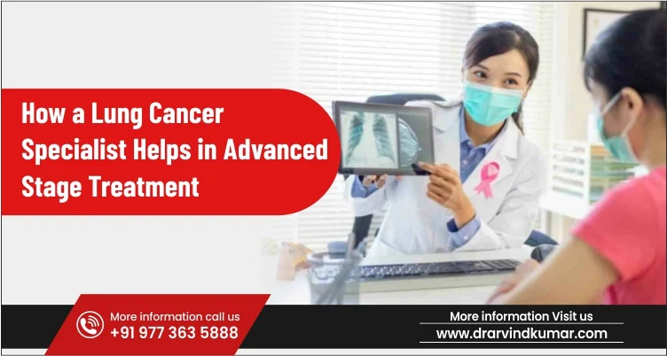 How a Lung Cancer Specialist Helps in Advanced Stage Treatment