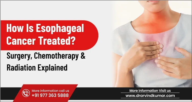 How Is Esophageal Cancer Treated? Surgery, Chemotherapy & Radiation Explained