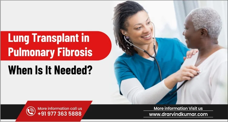 Lung Transplant in Pulmonary Fibrosis: When Is It Needed?