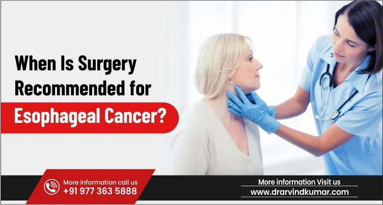 When Is Surgery Recommended for Esophageal Cancer?