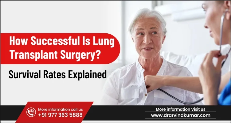 How Successful Is Lung Transplant Surgery? Survival Rates Explained